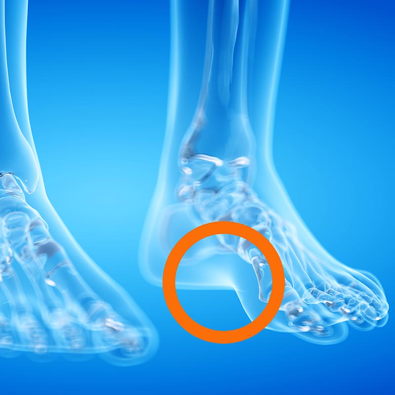 Arch Support Shoe Insoles